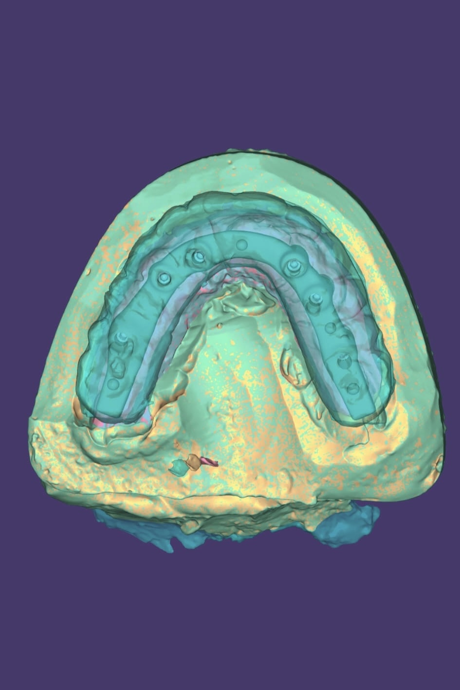 Digital dentistry workflow